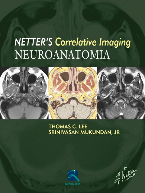 Livro: NEUROANATOMIA - NETTER'S CORRELATIVE IMAGING