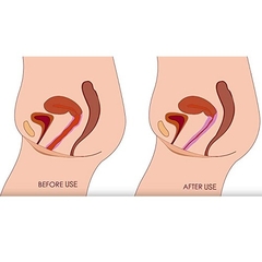 ST BOLA VAGINAL DE SILICONA PARA EJERCICIOS KEGEL BALL SI078 PURPLE en internet