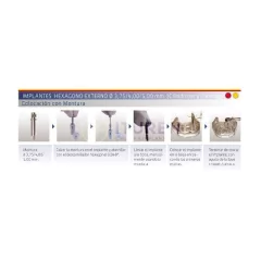 Implante Cilíndrico Hexágono Externo Ø5,00mm E2 Byw Implantes en internet