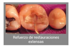 Interlig Fibra De Vidrio Trenzada Angelus - tienda online