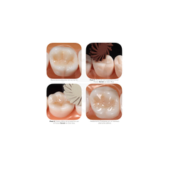 Kit Professional Polishing Composite 1921 Jota - tienda online