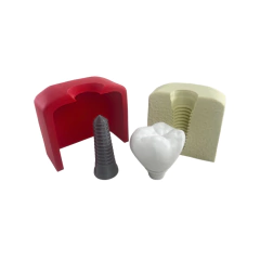 Maqueta Implante Dental - comprar online
