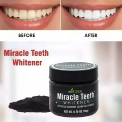 BLANQUEADOR DENTAL - Chucheriaslp