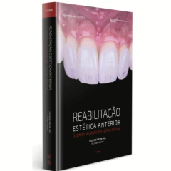 Reabilitação Estética Anterior - O Passo A Passo Da Rotina Clínica - Raphael Monte Alto E Colaboradores