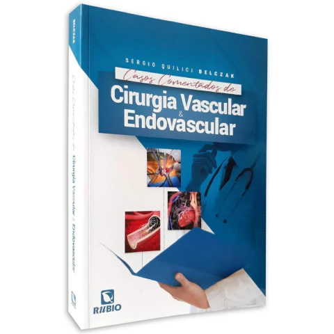 Livro: Casos Comentados De Cirurgia Vascular E Endovascular - Sergio Quilici Belczak