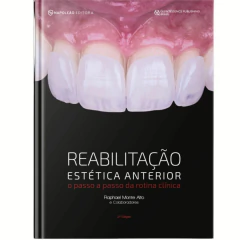 Reabilitação Estética Anterior - O Passo A Passo Da Rotina Clínica - Raphael Monte Alto E Colaboradores - comprar online