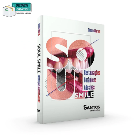 Soul Smile: Restaurações Cerâmicas Adesivas