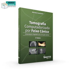 Tomografia Computadorizada Por Feixe Cônico