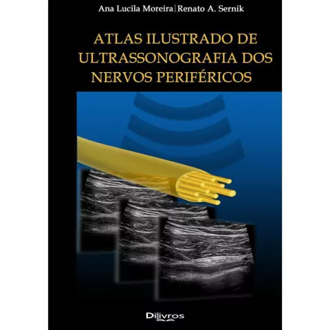 Atlas Ilustrado De Ultrassonografia Dos Nervos Periféricos - Ana Lucila Moreira E Renato A. Sernik