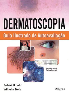 Livro: DERMATOSCOPIA GUIA ILUSTRADO DE AUTOAVALIACAO