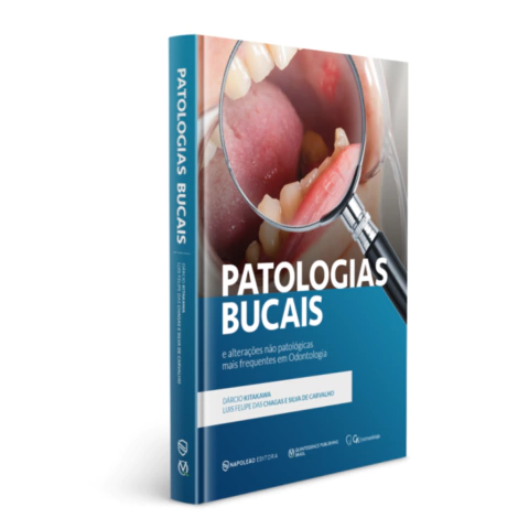 Livro: Patologias bucais e alterações não patológicas mais frequentes em odontologia