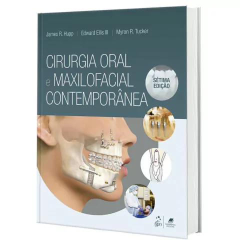 Cirurgia Oral E Maxilofacial Contemporânea - James R. Hupp, Edward Ellis Iii E Myron R. Tucker