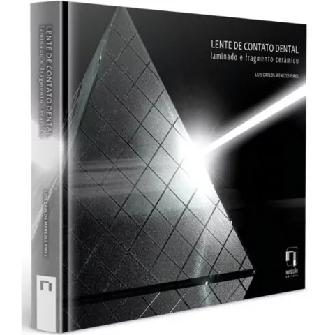 Lente De Contato Dental - Laminado E Fragmento Cerâmico - Luis Carlos Menezes Pires