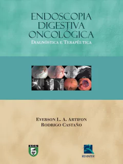 Livro: Endoscopia Digestiva Oncológica