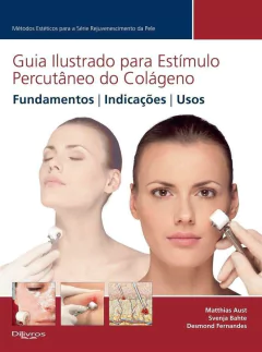 Livro: GUIA ILUSTRADO PARA ESTIMULO PERCUTANEO DO COLAGENEO
