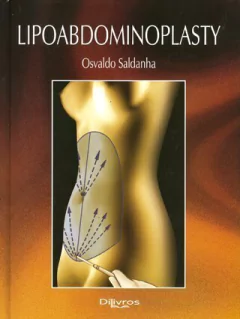 Livro: LIPOABDOMINOPLASTY