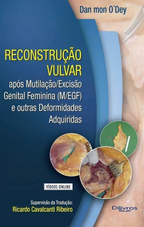 Livro: RECONSTRUCAO VULVAR COM VIDEO