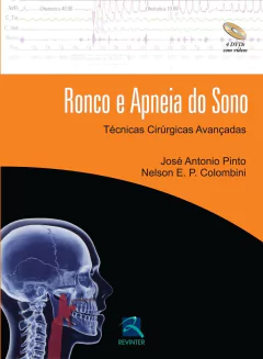 Livro: Ronco e Apneia do Sono