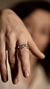 Anillo abrazo