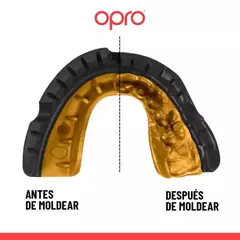BUCAL OPRO GOLD PARA BRACKETS MAXILAR SUPERIOR GEN 5 en internet