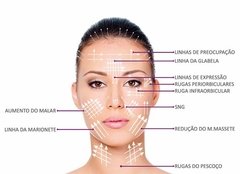 FIOS LISOS 27G / i-THREAD - PRÓSPERE FACE MEDICAMENTOS