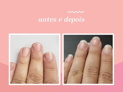 Hair Gummie Vitamins - HFORM - Gomas para Pele Cabelo e Unhas - loja online