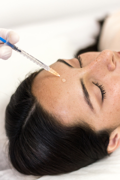 Mesoterapia facial y corporal