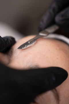 Dermaplaning