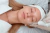 LIMPIEZA ROSACEA (DESCONGESTIÓN E HIDRATACIÓN)