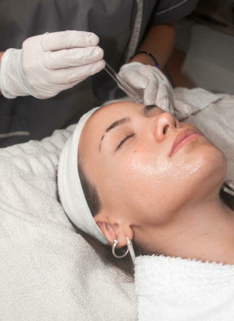 PEELING QUIMICO