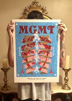 MGMT