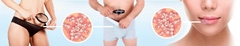 Banner da categoria Herpes