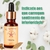 Vitória - Florais de Saint Germain | PharmaClinic Manipulação Personalizada