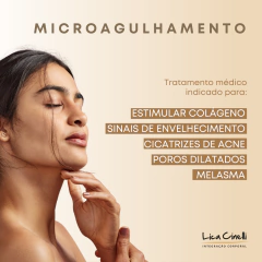 MICROAGULHAMENTO