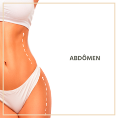 1 sessão EXILIS ULTRA 360º CORPORAL + X-WAVE CORPORAL - comprar online