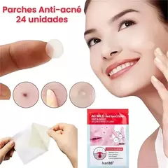 22 parches para el acne Karite dia y noche puntos negros