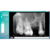 SENSOR INTRAORAL - TAMANHO 2 na internet
