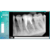 SENSOR INTRAORAL - TAMANHO 2 - comprar online