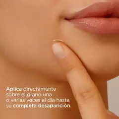 ISDIN ACNIBEN ON THE SPOT 15ML en internet