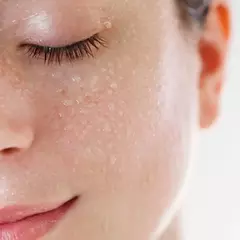 BYDERM FRESH SKIN ROXA 150ML - comprar online