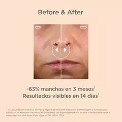 ISDIN ISDINCEUTICS MELACREAR REFILL 30ML