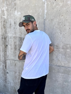 REMERA SYSTEM