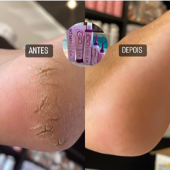 KIT TRATAMENTO PODAL (SPA PARA OS PÉS) na internet