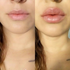 2 x 1 Labial voluminizador Karité 24K gold en internet