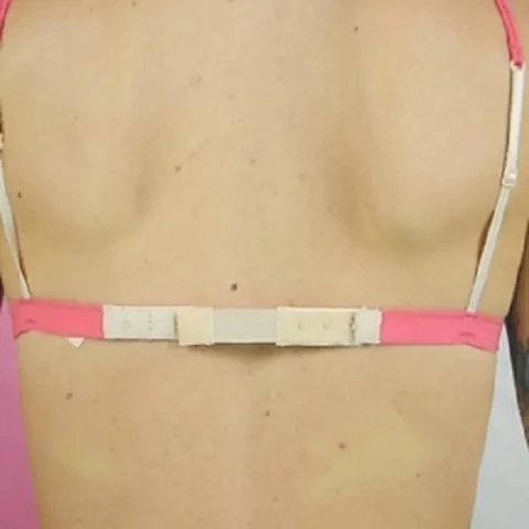 PROLONGADOR CORPINO 2CM 1 GANCHO (PRO202)