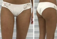 VEDETINA ALGODON C/ENCAJE (28EN)