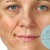 clareador la roche posay