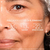serum menopausa