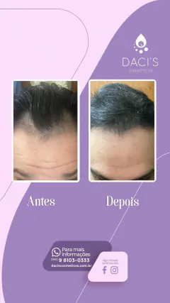 Condicionador Mega Hair - 250ml - loja online