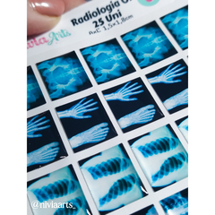 Apliques Resinado Radiologia - comprar online